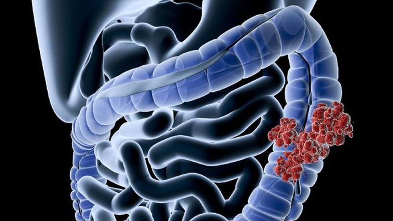 D:\2025\Februari 2025\18 Februari 2025\11\Halaman 1-11 Selasa\makanan.jpg