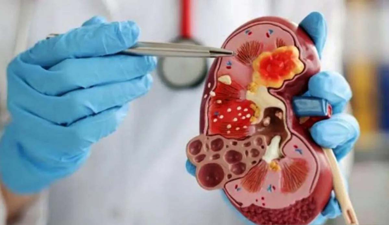 D:\2025\Maret 2025\11 Maret 2025\11\Halaman 1-11 Selasa\ciri.jpg