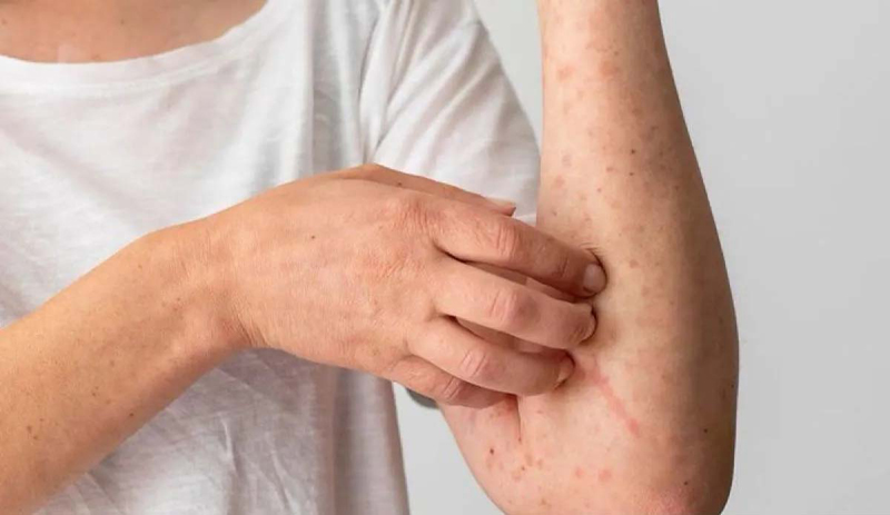 D:\2025\Juni 2025\10 Juni 2025\11\Halaman 1-11 Selasa\jika.jpg