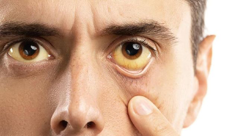 D:\2025\November 2025\17 November 2025\11\Halaman 1-11 Senin Baru\7 penyakit.jpg