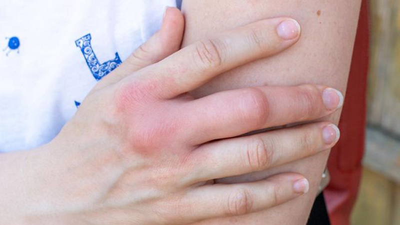 D:\2025\Desember 2025\11 Desember 2025\11\Halaman 1-11 Kamis\5 0bat.jpg