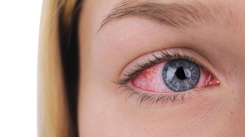 G:\2025\Desember 2025\30 Desember 2025\Halaman 1-11 Selasa\urat.jpg