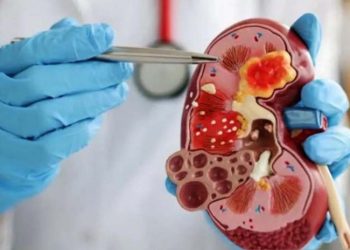 D:\2025\Maret 2025\11 Maret 2025\11\Halaman 1-11 Selasa\ciri.jpg