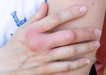 D:\2025\Desember 2025\11 Desember 2025\11\Halaman 1-11 Kamis\5 0bat.jpg