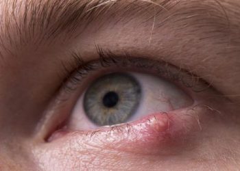 D:\2025\Desember 2025\8 Desember 2025\11\Halaman 1-11 Senin\Mudah.jpg