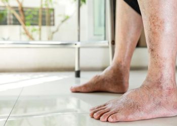 G:\2025\Desember 2025\22 Desember 2025\11\Halaman 1-11 Senin\letak.jpg